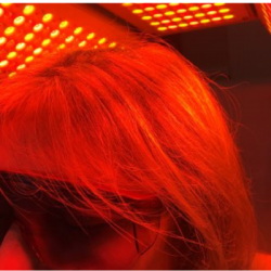 Chute de cheveux traitement par luminothérapie centre esthétique avancée